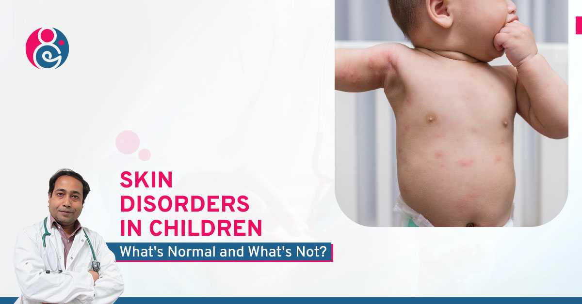 Skin Disorders in Children: What's Normal and What's Not?