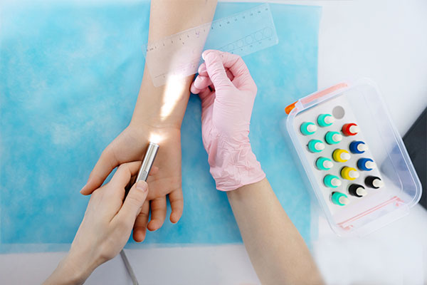 Allergy Testing